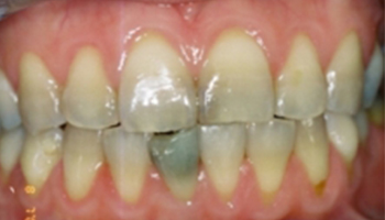 Oakridge Smiles - Before and After
