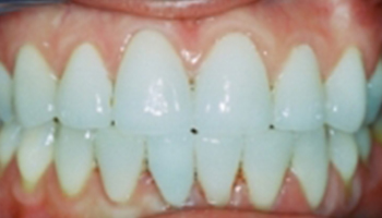 Oakridge Smiles - Before and After