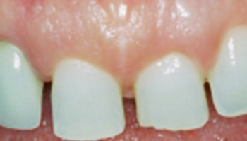 Oakridge Smiles - Before and After