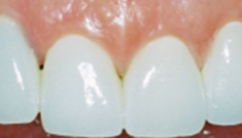 Oakridge Smiles - Before and After