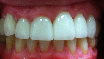 After image