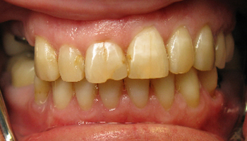 Before image